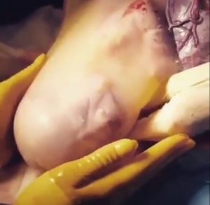 baby-born-in-amniotic-sac